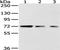 Heterogeneous Nuclear Ribonucleoprotein M antibody, TA351937, Origene, Western Blot image 