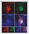 Integrin Subunit Alpha 5 antibody, NBP2-50146, Novus Biologicals, Immunofluorescence image 