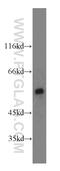 Calcium/Calmodulin Dependent Protein Kinase II Beta antibody, 20667-1-AP, Proteintech Group, Western Blot image 