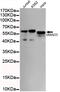 SMAD Family Member 5 antibody, MBS475034, MyBioSource, Western Blot image 