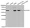 Epoxide Hydrolase 1 antibody, abx001686, Abbexa, Western Blot image 