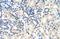 Poly(A) Binding Protein Cytoplasmic 4 antibody, A07960-1, Boster Biological Technology, Immunohistochemistry paraffin image 