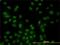 Serine/Threonine Kinase 17b antibody, H00009262-M01, Novus Biologicals, Immunofluorescence image 