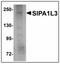 Signal Induced Proliferation Associated 1 Like 3 antibody, AP23920PU-N, Origene, Western Blot image 