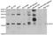 Anterior Gradient 2, Protein Disulphide Isomerase Family Member antibody, A7064, ABclonal Technology, Western Blot image 