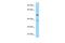 TRNA Splicing Endonuclease Subunit 2 antibody, A13172, Boster Biological Technology, Western Blot image 