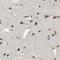 Lysine Demethylase 7A antibody, HPA012114, Atlas Antibodies, Immunohistochemistry paraffin image 