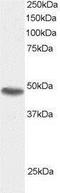 Sorting Nexin 15 antibody, NB100-1210, Novus Biologicals, Western Blot image 