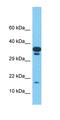 Transmembrane Protein 220 antibody, orb325153, Biorbyt, Western Blot image 