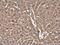 Cofilin 1 antibody, GTX632582, GeneTex, Immunohistochemistry paraffin image 