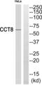 Chaperonin Containing TCP1 Subunit 8 antibody, abx014942, Abbexa, Western Blot image 