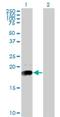 NPC Intracellular Cholesterol Transporter 2 antibody, H00010577-M01, Novus Biologicals, Western Blot image 