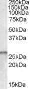 Survival Of Motor Neuron 2, Centromeric antibody, EB07704, Everest Biotech, Western Blot image 