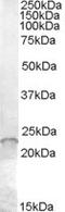 Anti-Silencing Function 1A Histone Chaperone antibody, NB100-93376, Novus Biologicals, Western Blot image 