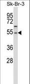 Protein Phosphatase, Mg2+/Mn2+ Dependent 1A antibody, LS-C162070, Lifespan Biosciences, Western Blot image 