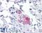 Stromal Interaction Molecule 1 antibody, LS-B4424, Lifespan Biosciences, Immunohistochemistry paraffin image 