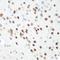 Cyclin Dependent Kinase 1 antibody, LS-C747516, Lifespan Biosciences, Immunohistochemistry paraffin image 