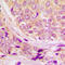 Cycb1 antibody, GTX55051, GeneTex, Immunohistochemistry paraffin image 