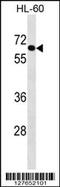 Crystallin Beta-Gamma Domain Containing 2 antibody, 58-419, ProSci, Western Blot image 