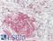 Adenosine A2a Receptor antibody, LS-B14076, Lifespan Biosciences, Immunohistochemistry paraffin image 