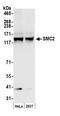 Structural Maintenance Of Chromosomes 2 antibody, NB100-373, Novus Biologicals, Western Blot image 