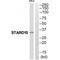 StAR Related Lipid Transfer Domain Containing 10 antibody, A10577, Boster Biological Technology, Western Blot image 