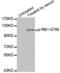 RB Transcriptional Corepressor 1 antibody, abx000160, Abbexa, Western Blot image 