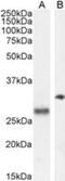Proopiomelanocortin antibody, NB100-1533, Novus Biologicals, Western Blot image 