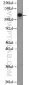 Adaptor Related Protein Complex 3 Subunit Beta 2 antibody, 18331-1-AP, Proteintech Group, Enzyme Linked Immunosorbent Assay image 