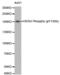 Erb-B2 Receptor Tyrosine Kinase 4 antibody, abx000119, Abbexa, Western Blot image 