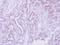 Cell Adhesion Associated, Oncogene Regulated antibody, PA5-28245, Invitrogen Antibodies, Immunohistochemistry frozen image 