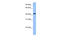 Chromosome 8 Open Reading Frame 34 antibody, 30-821, ProSci, Western Blot image 