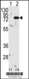 Protein Kinase C Beta antibody, 62-591, ProSci, Western Blot image 