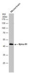 Chromosome 17 Open Reading Frame 75 antibody, GTX108779, GeneTex, Western Blot image 