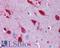 Ribonucleic Acid Export 1 antibody, LS-B4325, Lifespan Biosciences, Immunohistochemistry paraffin image 