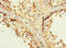 Interferon Lambda Receptor 1 antibody, LS-C675880, Lifespan Biosciences, Immunohistochemistry paraffin image 