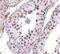 Mediator Complex Subunit 4 antibody, PA5-20571, Invitrogen Antibodies, Immunohistochemistry paraffin image 