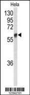 Polypeptide N-Acetylgalactosaminyltransferase 2 antibody, 63-901, ProSci, Western Blot image 