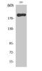 Myosin Heavy Chain 14 antibody, A04528-1, Boster Biological Technology, Western Blot image 