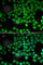 Transient Receptor Potential Cation Channel Subfamily M Member 2 antibody, A6137, ABclonal Technology, Immunofluorescence image 