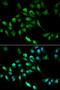 Alcohol Dehydrogenase 5 (Class III), Chi Polypeptide antibody, LS-C331843, Lifespan Biosciences, Immunofluorescence image 