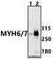 Myosin Heavy Chain 6 antibody, A02808, Boster Biological Technology, Western Blot image 