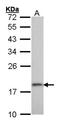 Ribosomal Protein S10 antibody, NBP1-31357, Novus Biologicals, Western Blot image 