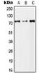 Dynein Cytoplasmic 1 Intermediate Chain 2 antibody, LS-C353716, Lifespan Biosciences, Western Blot image 