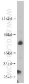 Potassium Voltage-Gated Channel Subfamily J Member 8 antibody, 14954-1-AP, Proteintech Group, Western Blot image 