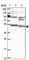 STAM Binding Protein Like 1 antibody, PA5-59103, Invitrogen Antibodies, Western Blot image 