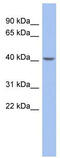 Zinc Finger Protein 302 antibody, TA338036, Origene, Western Blot image 