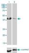 Carbonic Anhydrase 12 antibody, H00000771-M01, Novus Biologicals, Western Blot image 