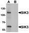 SIK Family Kinase 3 antibody, orb75700, Biorbyt, Western Blot image 