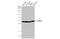 Survival Motor Neuron Domain Containing 1 antibody, GTX118263, GeneTex, Western Blot image 